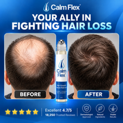 Hair Growth Roll On Serum